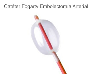 Catéter Fogarty Embolectomía Arterial